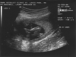baby5.jpg